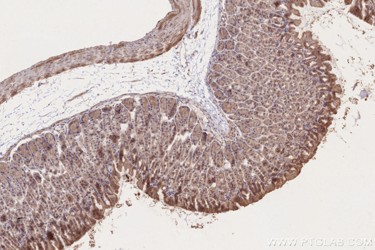 Immunohistochemical analysis of paraffin-embedded mouse stomach tissue slide using KHC2691 (PIK3C3/VPS34 IHC Kit).