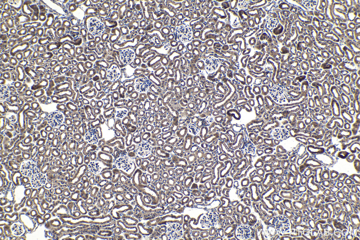 Immunohistochemical analysis of paraffin-embedded mouse kidney tissue slide using KHC1059 (PIK3CA IHC Kit).