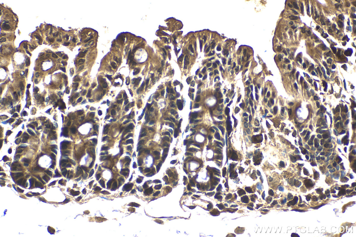 Immunohistochemical analysis of paraffin-embedded mouse intestine tissue slide using KHC2045 (PIK3R2 IHC Kit).
