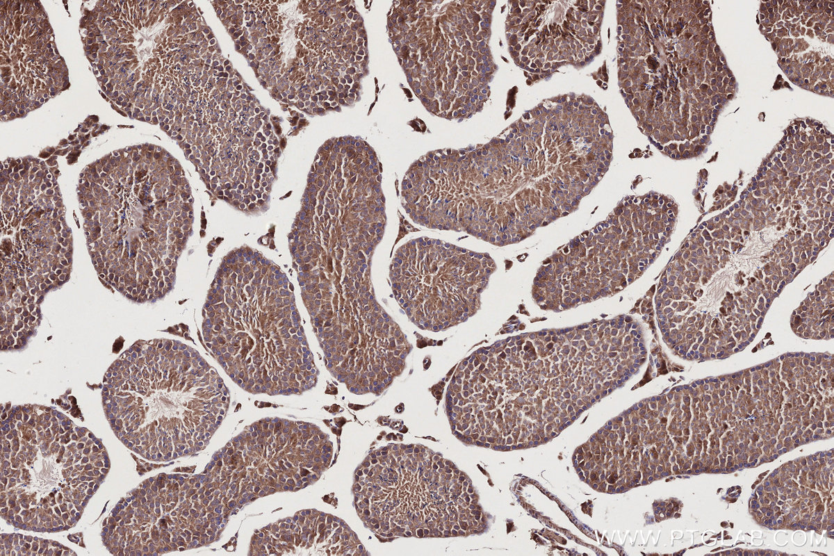 Immunohistochemical analysis of paraffin-embedded mouse testis tissue slide using KHC2746 (PIK3R3 IHC Kit).