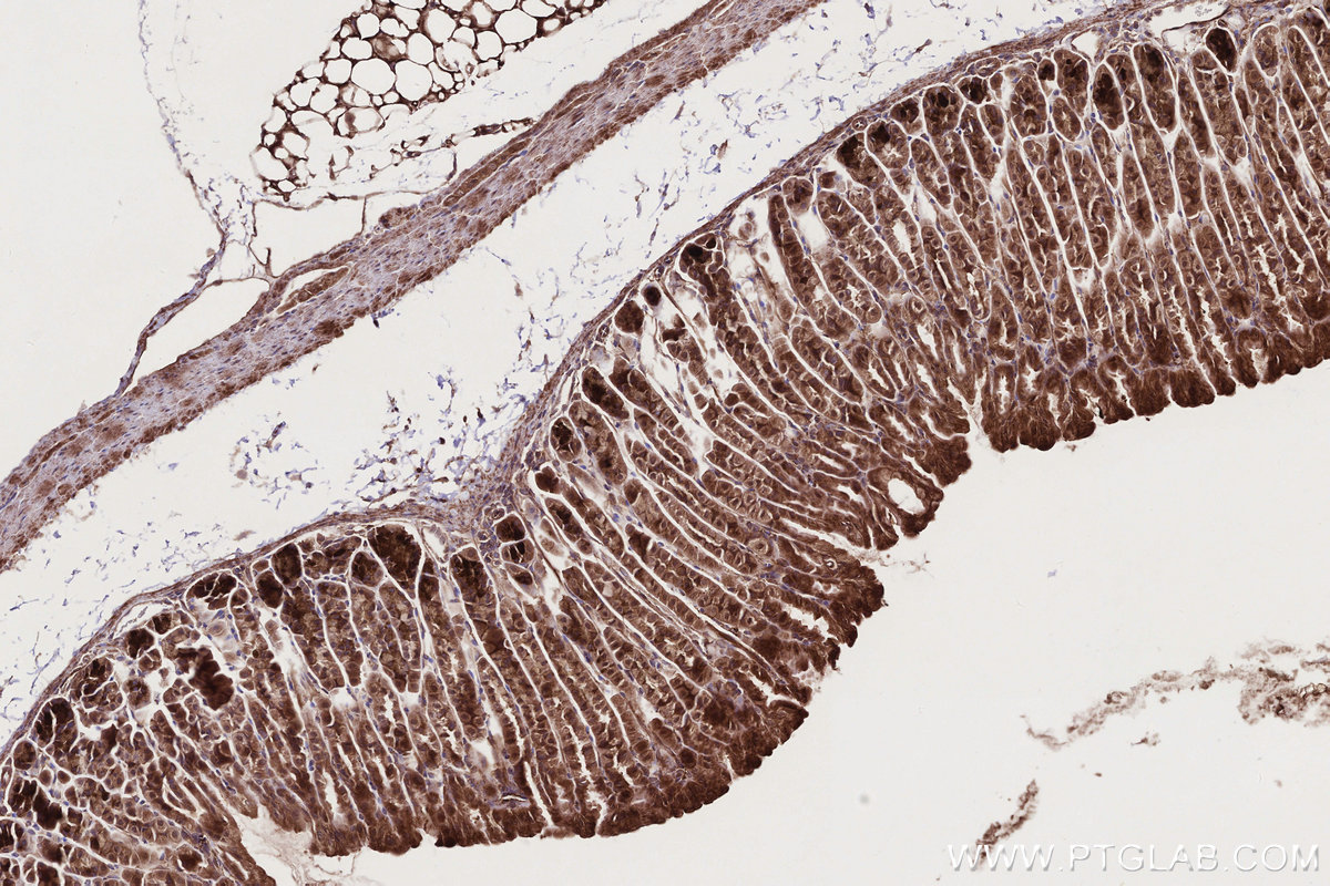 Immunohistochemical analysis of paraffin-embedded mouse stomach tissue slide using KHC2746 (PIK3R3 IHC Kit).
