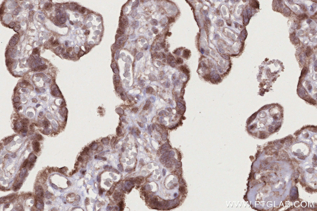 Immunohistochemical analysis of paraffin-embedded human placenta tissue slide using KHC2746 (PIK3R3 IHC Kit).