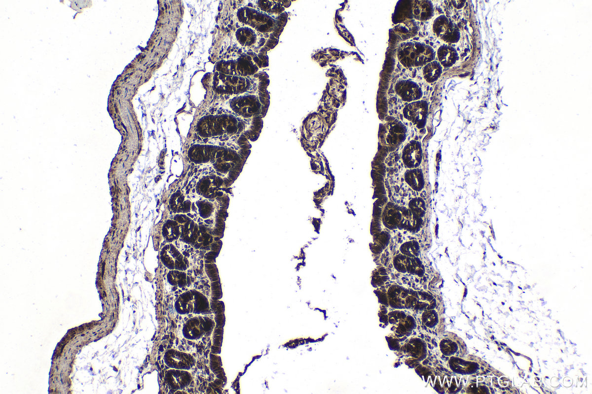 Immunohistochemical analysis of paraffin-embedded rat colon tissue slide using KHC1524 (PIM1 IHC Kit).