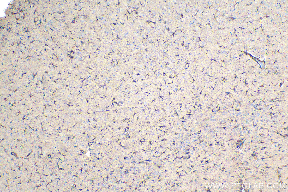 Immunohistochemical analysis of paraffin-embedded rat brain tissue slide using KHC1071 (PINK1 IHC Kit).