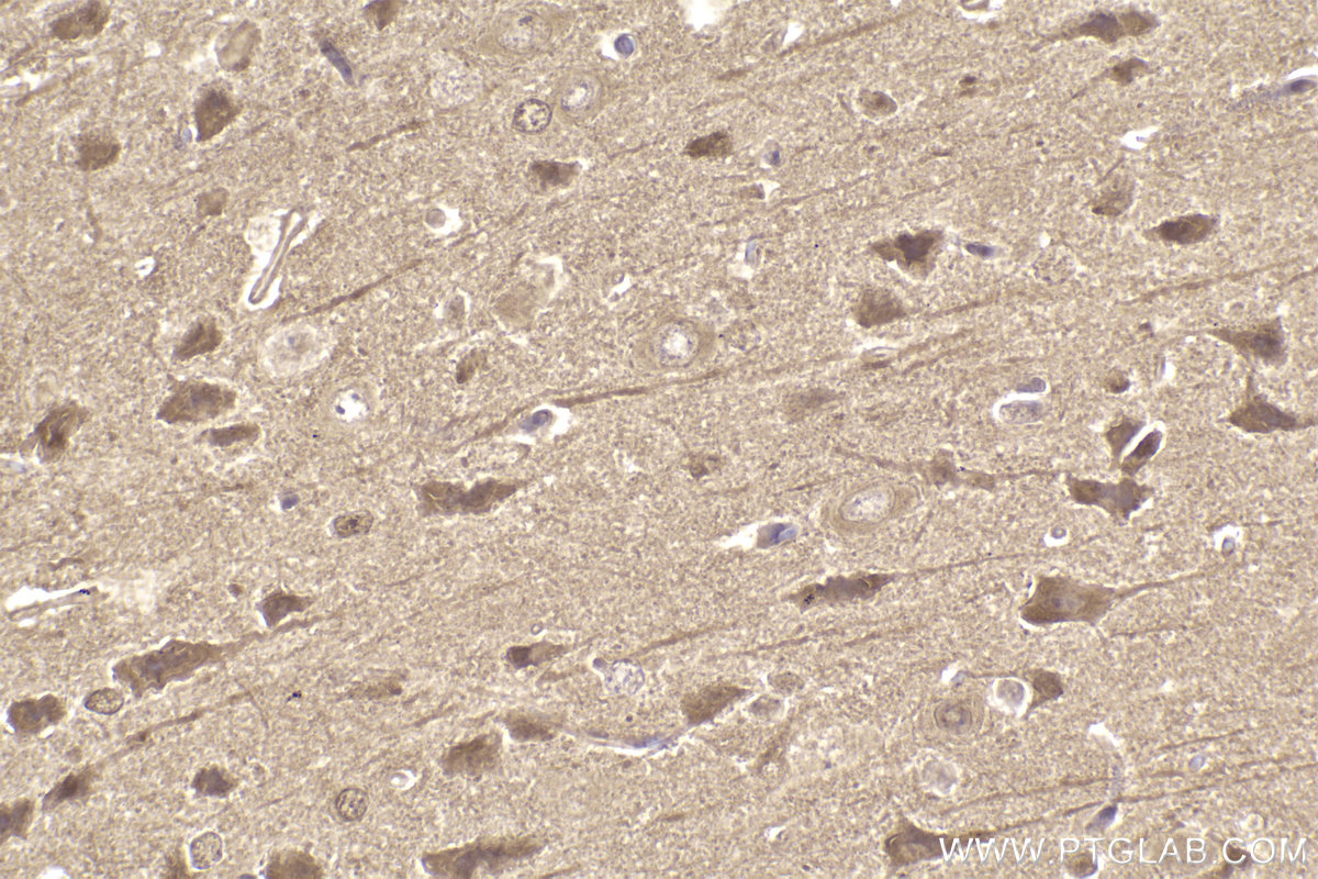 Immunohistochemical analysis of paraffin-embedded rat brain tissue slide using KHC2282 (PIP4K2A IHC Kit).