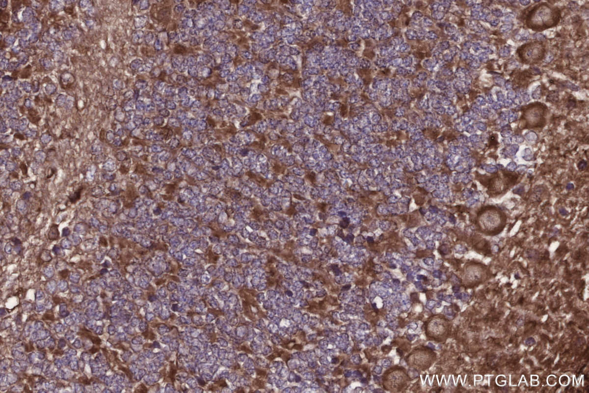 Immunohistochemical analysis of paraffin-embedded mouse cerebellum tissue slide using KHC2709 (PIP4K2C IHC Kit).