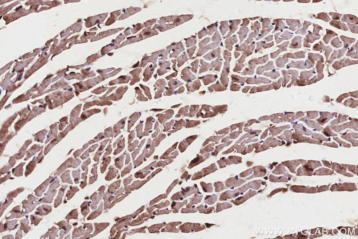 Immunohistochemical analysis of paraffin-embedded mouse heart tissue slide using KHC2848 (PIP5K1A IHC Kit).