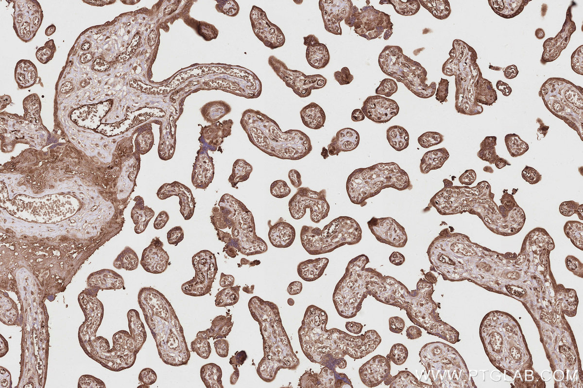 Immunohistochemical analysis of paraffin-embedded human placenta tissue slide using KHC2848 (PIP5K1A IHC Kit).