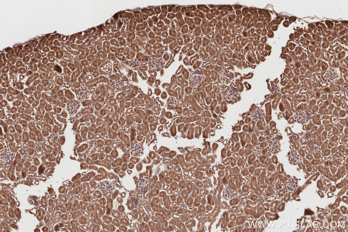 Immunohistochemical analysis of paraffin-embedded mouse kidney tissue slide using KHC2848 (PIP5K1A IHC Kit).