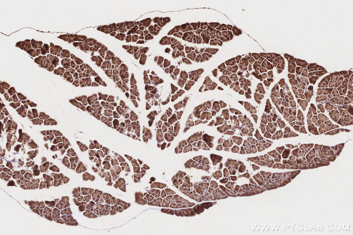 Immunohistochemical analysis of paraffin-embedded mouse pancreas tissue slide using KHC2848 (PIP5K1A IHC Kit).