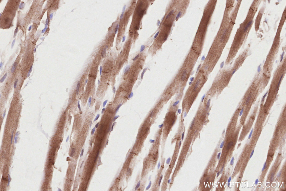 Immunohistochemical analysis of paraffin-embedded rat heart tissue slide using KHC2848 (PIP5K1A IHC Kit).