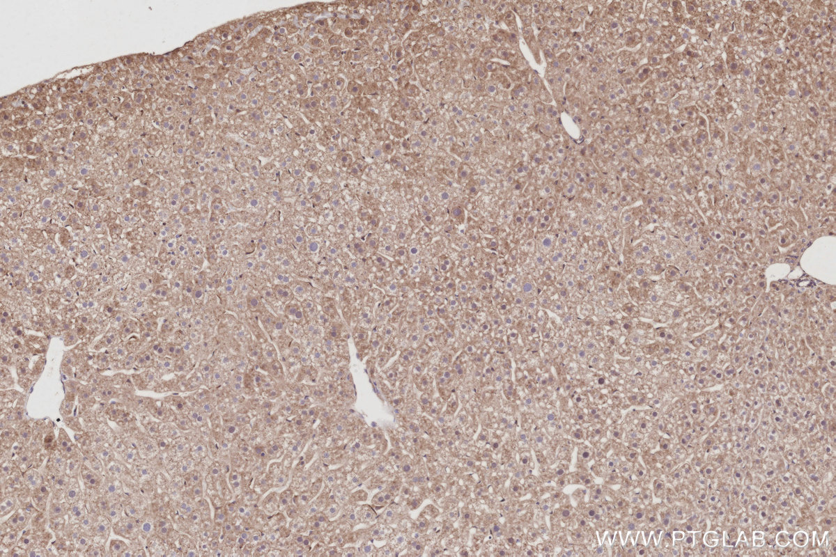 Immunohistochemical analysis of paraffin-embedded mouse liver tissue slide using KHC3054 (PIP5K3 IHC Kit). Immunohistochemical analysis of paraffin-embedded mouse liver tissue slide using KHC3054 (PIP5K3 IHC Kit).