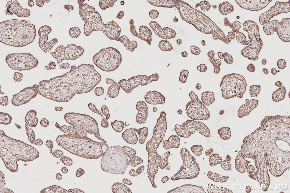 Immunohistochemical analysis of paraffin-embedded human placenta tissue slide using KHC3054 (PIP5K3 IHC Kit). Immunohistochemical analysis of paraffin-embedded human placenta tissue slide using KHC3054 (PIP5K3 IHC Kit).