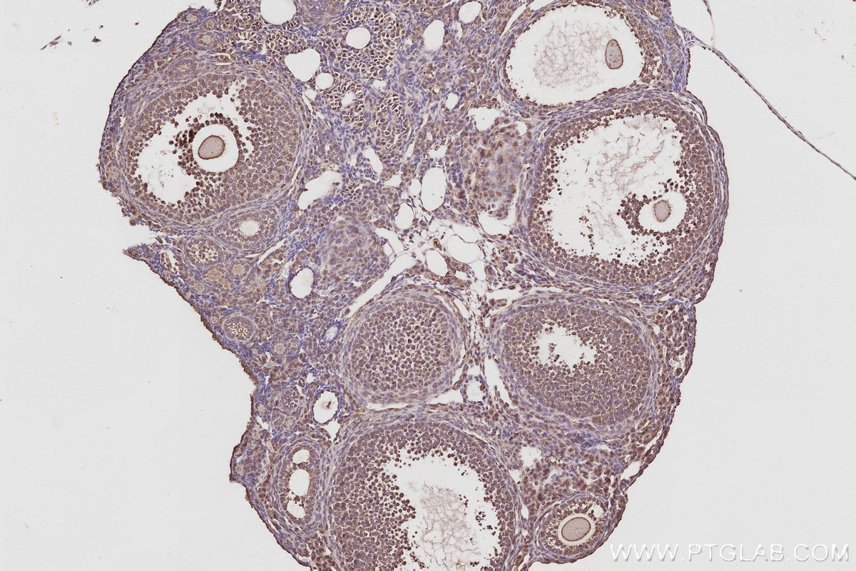 Immunohistochemical analysis of paraffin-embedded mouse ovary tissue slide using KHC3054 (PIP5K3 IHC Kit). Immunohistochemical analysis of paraffin-embedded mouse ovary tissue slide using KHC3054 (PIP5K3 IHC Kit).