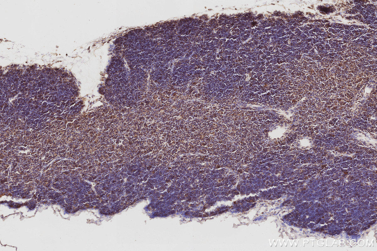 Immunohistochemical analysis of paraffin-embedded mouse thymus tissue slide using KHC3054 (PIP5K3 IHC Kit). Immunohistochemical analysis of paraffin-embedded mouse thymus tissue slide using KHC3054 (PIP5K3 IHC Kit).
