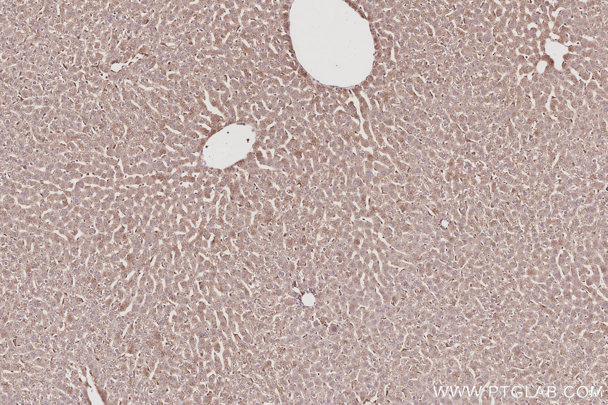 Immunohistochemical analysis of paraffin-embedded rat liver tissue slide using KHC3054 (PIP5K3 IHC Kit). Immunohistochemical analysis of paraffin-embedded rat liver tissue slide using KHC3054 (PIP5K3 IHC Kit).
