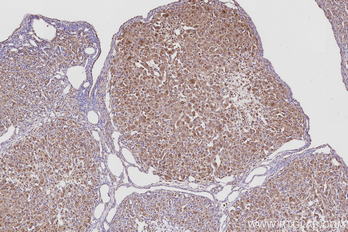 Immunohistochemical analysis of paraffin-embedded rat ovary tissue slide using KHC3054 (PIP5K3 IHC Kit). Immunohistochemical analysis of paraffin-embedded rat ovary tissue slide using KHC3054 (PIP5K3 IHC Kit).