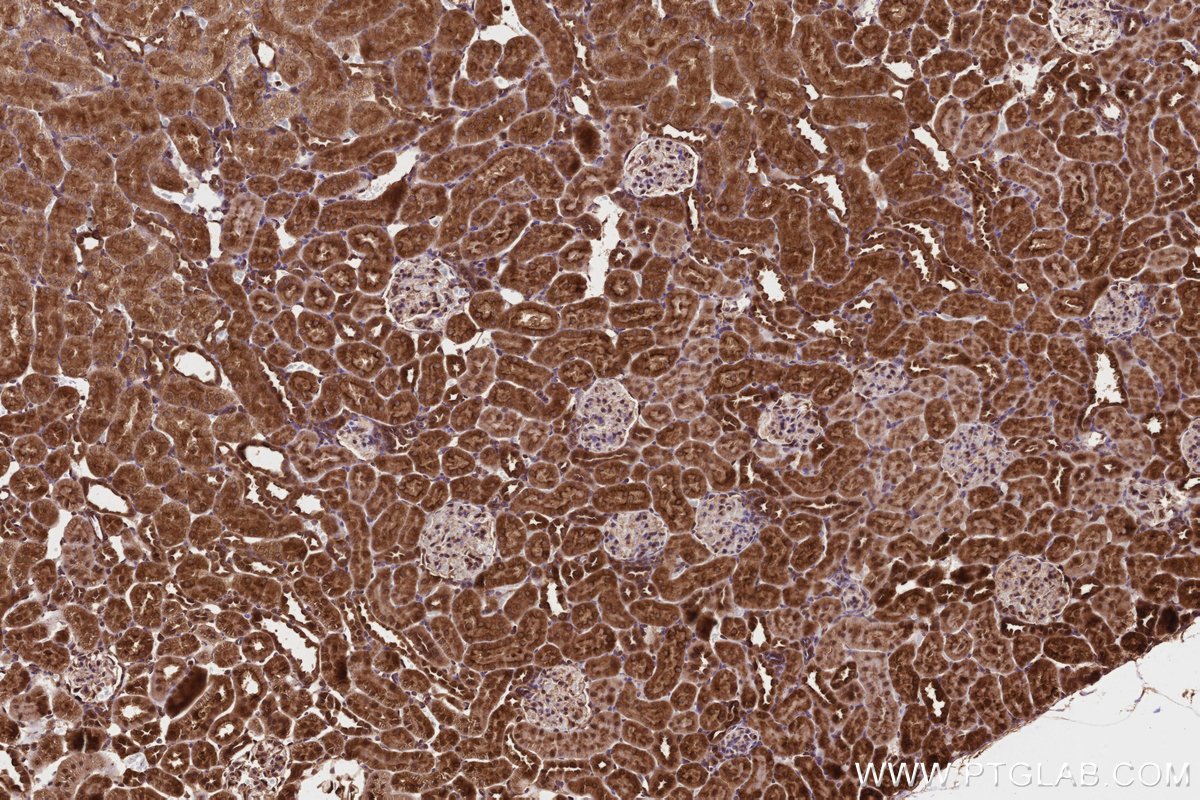 Immunohistochemical analysis of paraffin-embedded rat kidney tissue slide using KHC3215 (PITPNB IHC Kit). Immunohistochemical analysis of paraffin-embedded rat kidney tissue slide using KHC3215 (PITPNB IHC Kit).