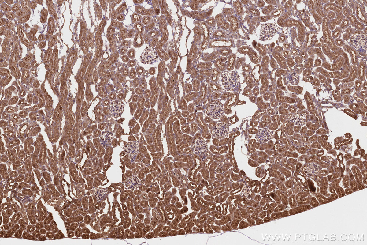 Immunohistochemical analysis of paraffin-embedded mouse kidney tissue slide using KHC3215 (PITPNB IHC Kit). Immunohistochemical analysis of paraffin-embedded mouse kidney tissue slide using KHC3215 (PITPNB IHC Kit).