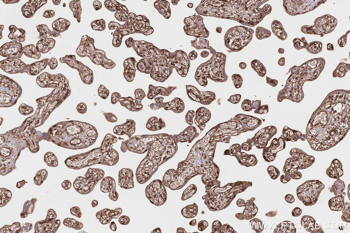Immunohistochemical analysis of paraffin-embedded human placenta tissue slide using KHC3215 (PITPNB IHC Kit). Immunohistochemical analysis of paraffin-embedded human placenta tissue slide using KHC3215 (PITPNB IHC Kit).