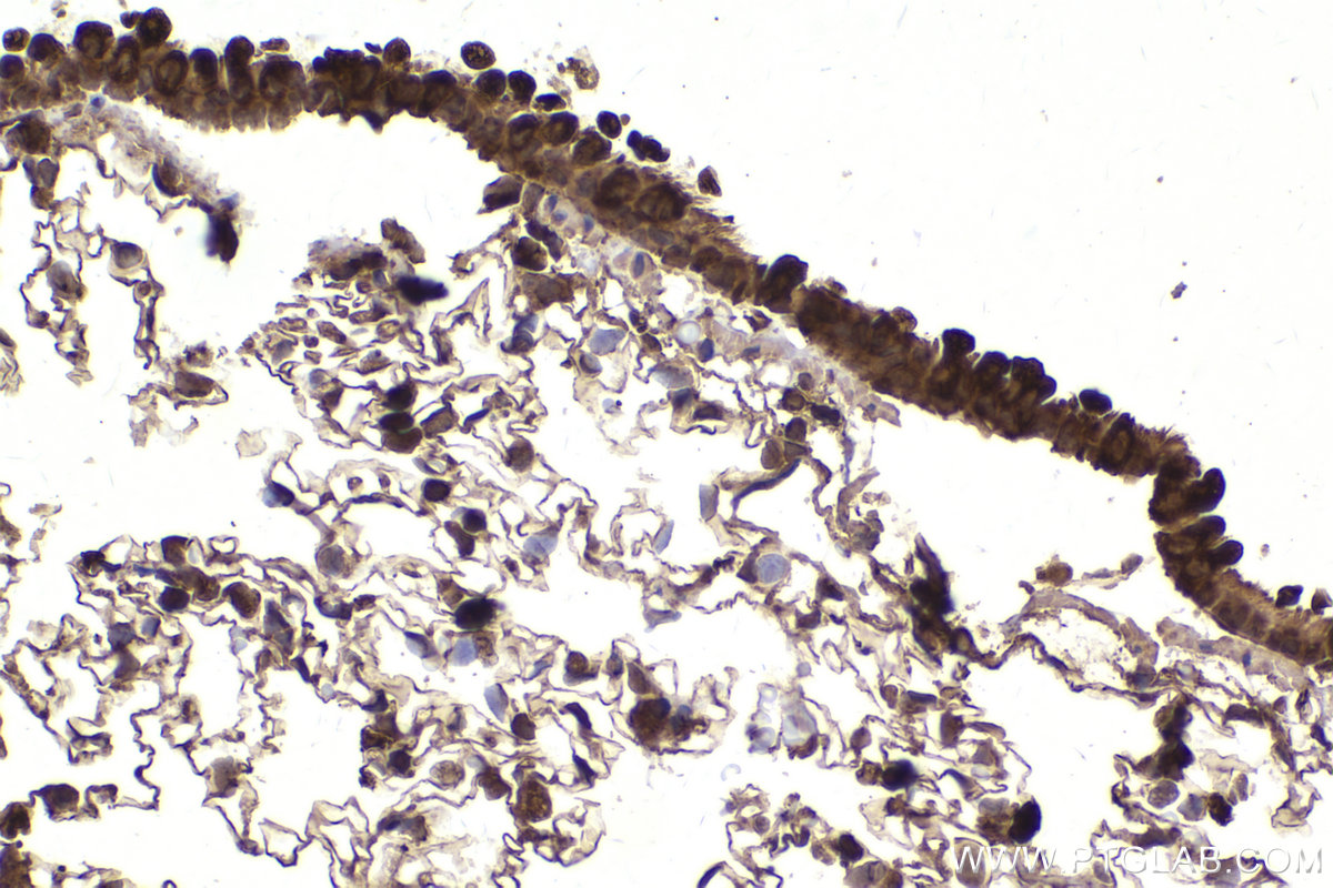 Immunohistochemical analysis of paraffin-embedded rat lung tissue slide using KHC2184 (PKM2 IHC Kit).