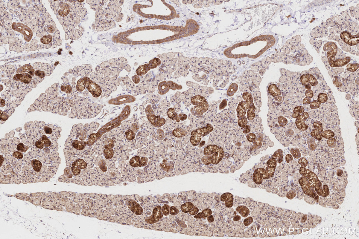 Immunohistochemical analysis of paraffin-embedded rat salivary gland tissue slide using KHC2842 (PKP4 IHC Kit).