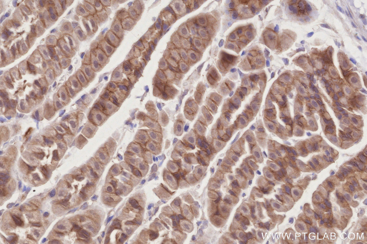 Immunohistochemical analysis of paraffin-embedded mouse stomach tissue slide using KHC2842 (PKP4 IHC Kit).