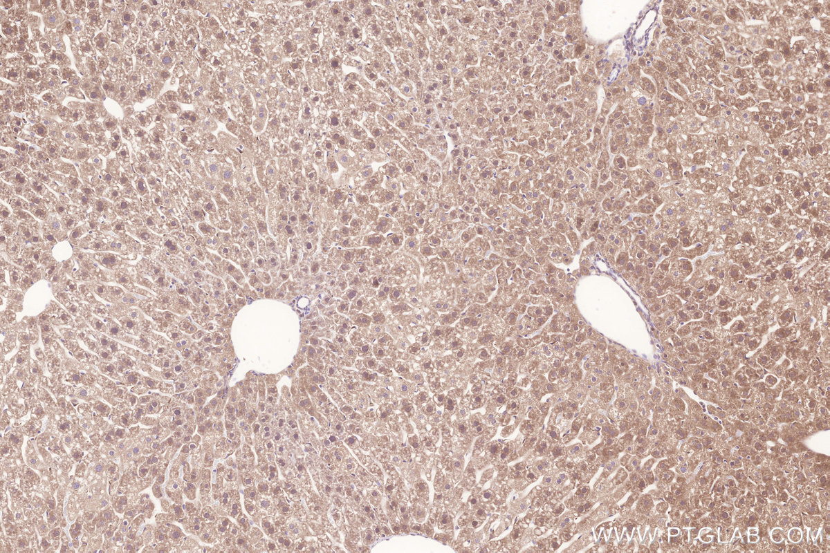 Immunohistochemical analysis of paraffin-embedded mouse liver tissue slide using KHC3293 (PLA2G15/LYPLA3 IHC Kit).