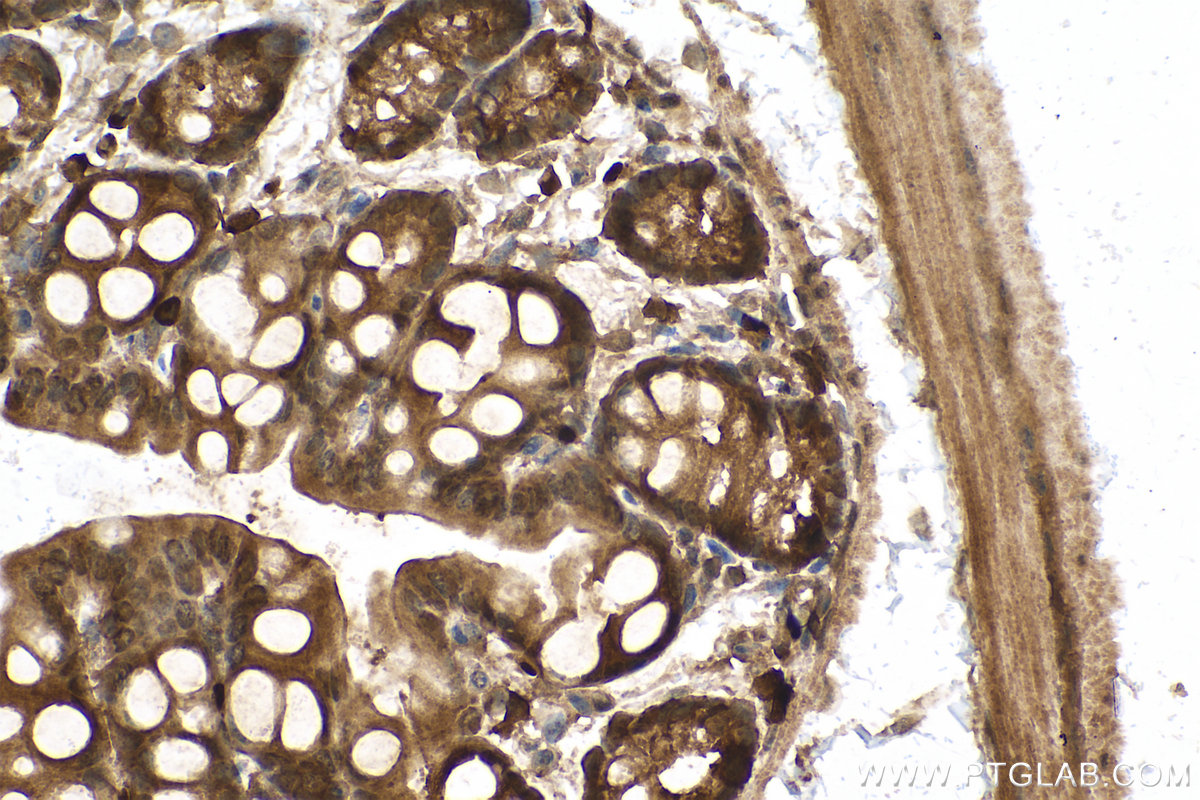 Immunohistochemical analysis of paraffin-embedded mouse colon tissue slide using KHC0774 (PLAA IHC Kit).