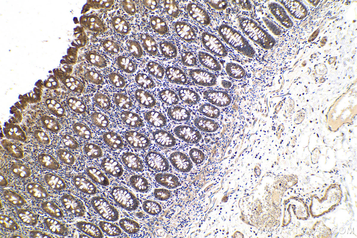 Immunohistochemical analysis of paraffin-embedded human colon tissue slide using KHC0598 (Phospholipase C epsilon 1 IHC Kit).