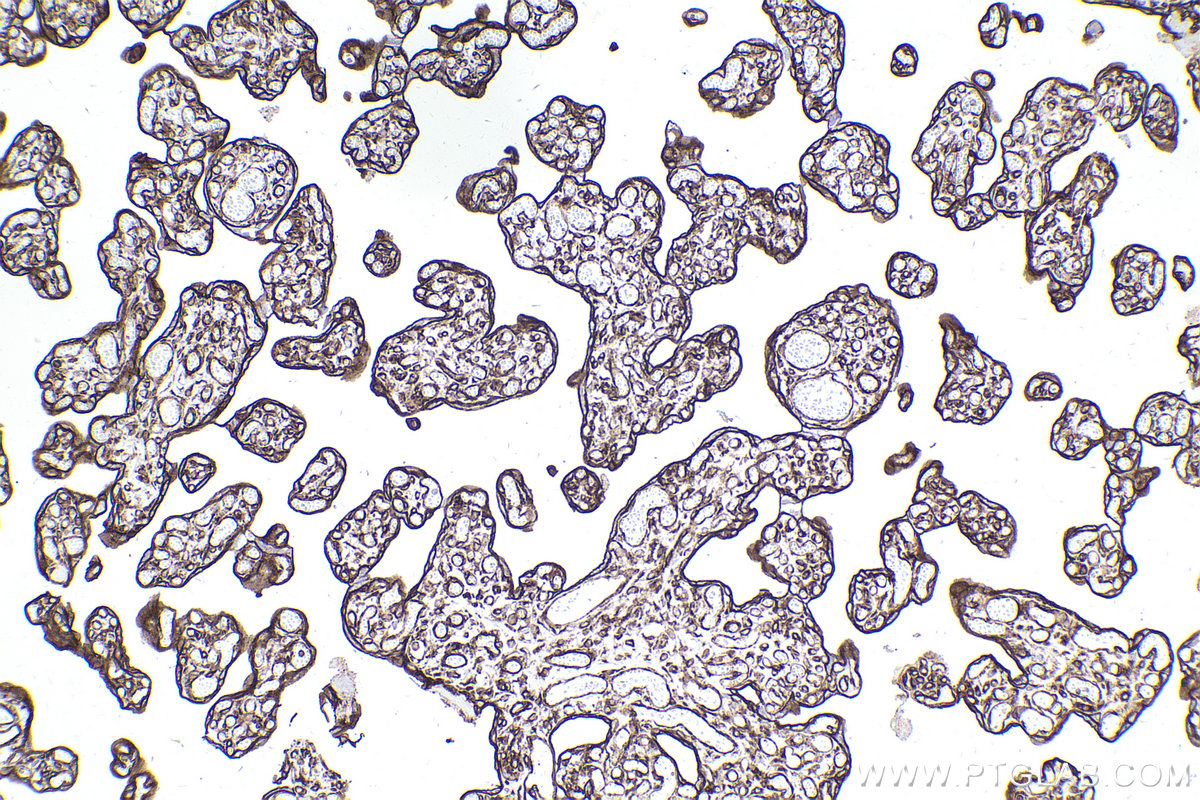 Immunohistochemical analysis of paraffin-embedded human placenta tissue slide using KHC2482 (PLEC IHC Kit).