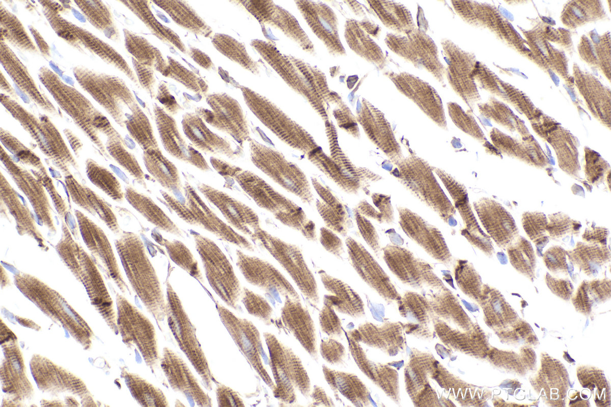 Immunohistochemical analysis of paraffin-embedded rat heart tissue slide using KHC2482 (PLEC IHC Kit).