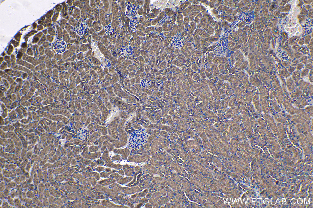 Immunohistochemical analysis of paraffin-embedded mouse kidney tissue slide using KHC1222 (PLK4 IHC Kit).