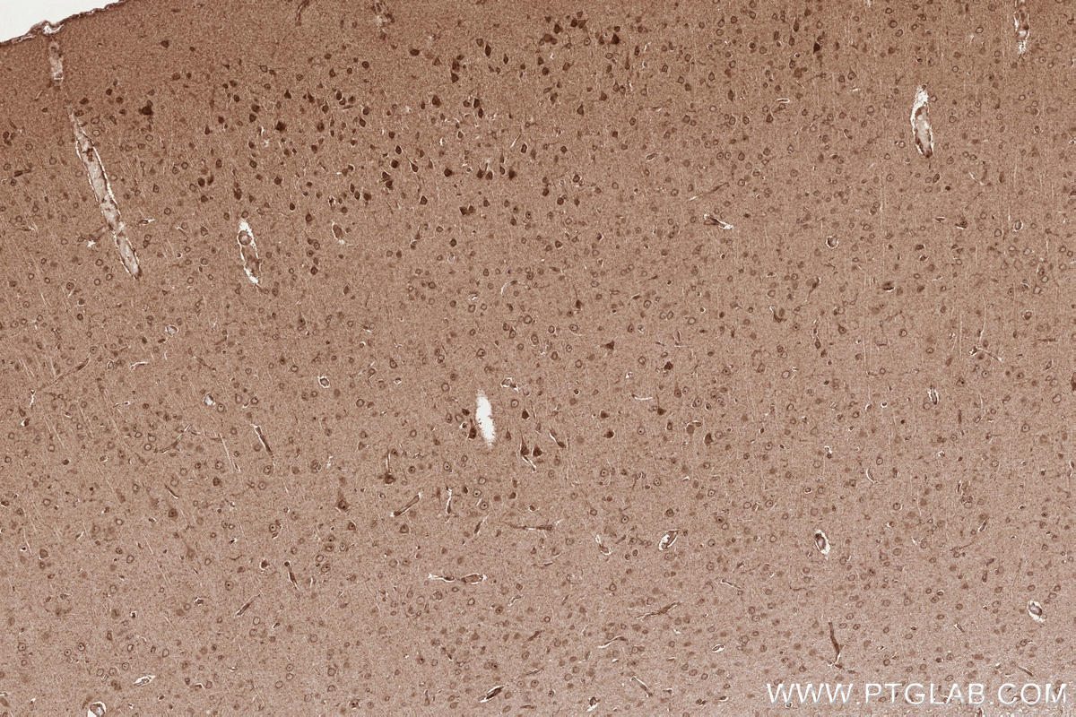 Immunohistochemical analysis of paraffin-embedded rat brain tissue slide using KHC2529 (PLK5P IHC Kit).