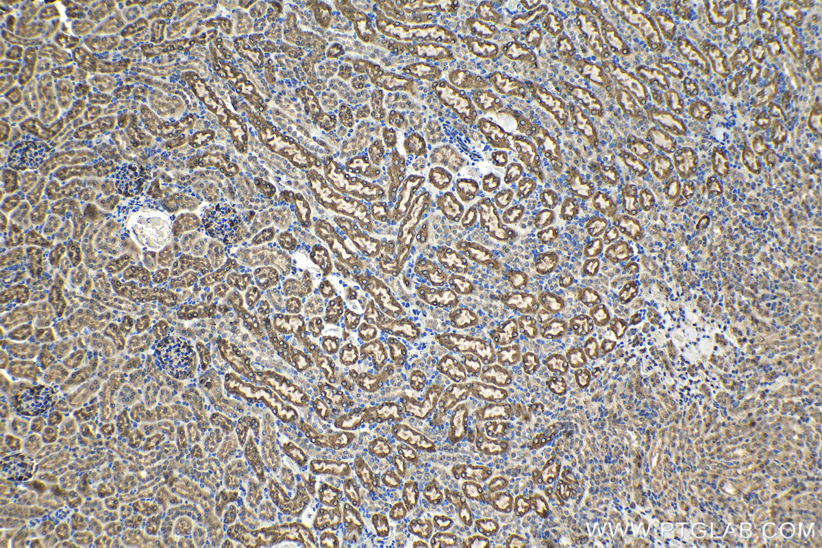 Immunohistochemical analysis of paraffin-embedded mouse kidney tissue slide using KHC1240 (PLOD2 IHC Kit).