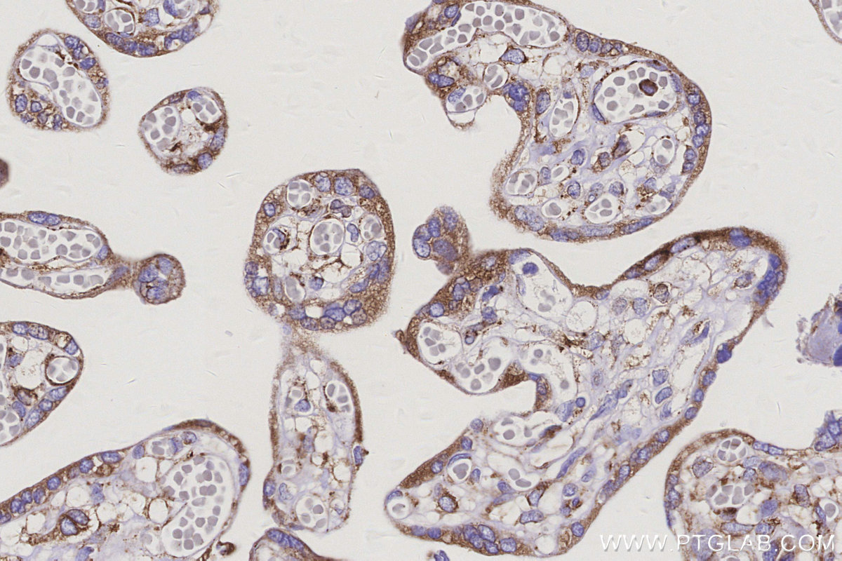 Immunohistochemical analysis of paraffin-embedded human placenta tissue slide using KHC3147 (PLOD3 IHC Kit).