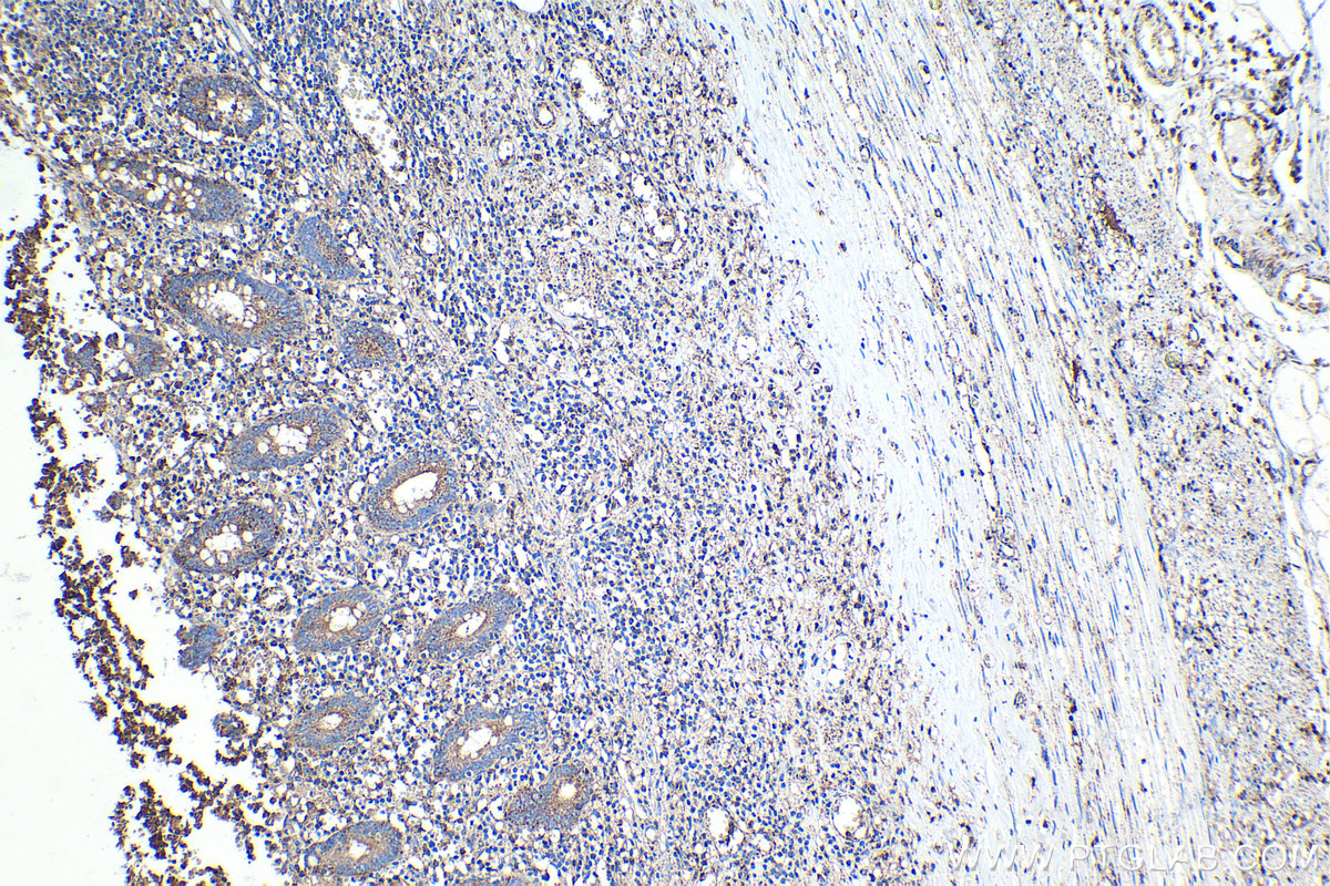 Immunohistochemical analysis of paraffin-embedded human appendicitis tissue slide using KHC1436 (PLSCR1 IHC Kit).