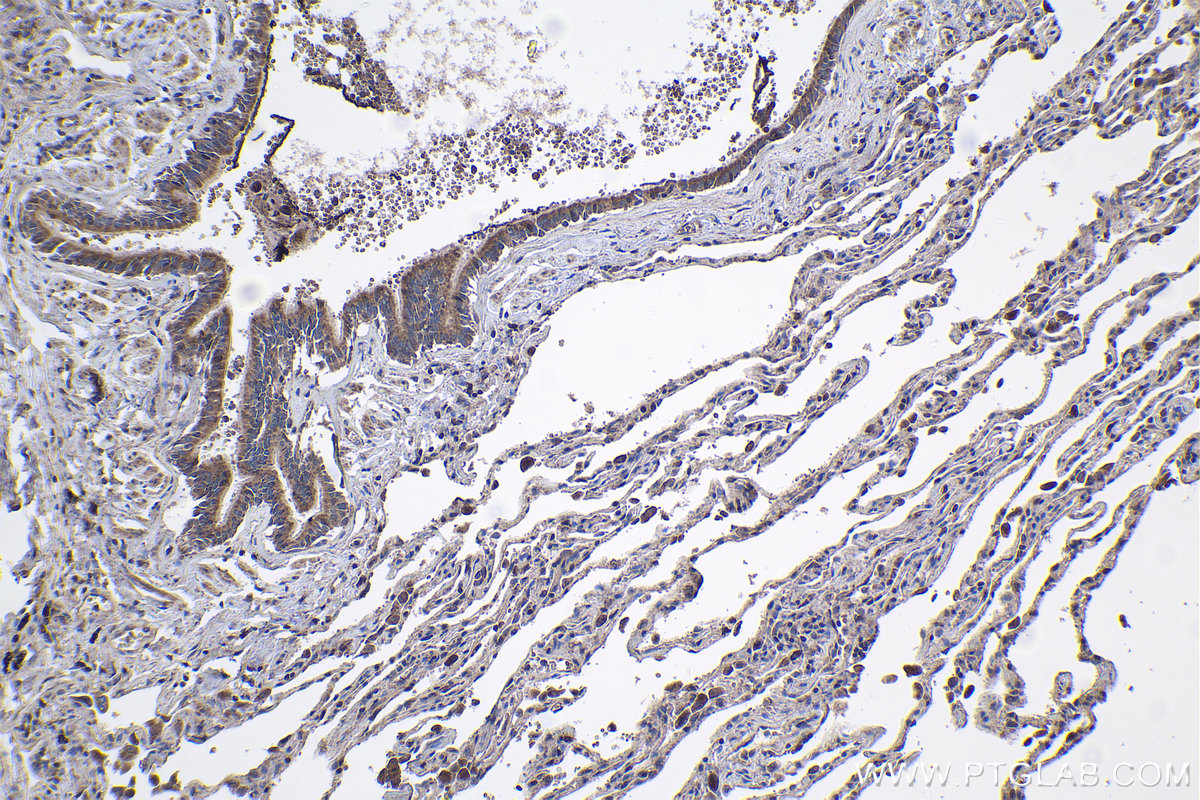 Immunohistochemical analysis of paraffin-embedded human lung tissue slide using KHC1090 (PLUNC IHC Kit).