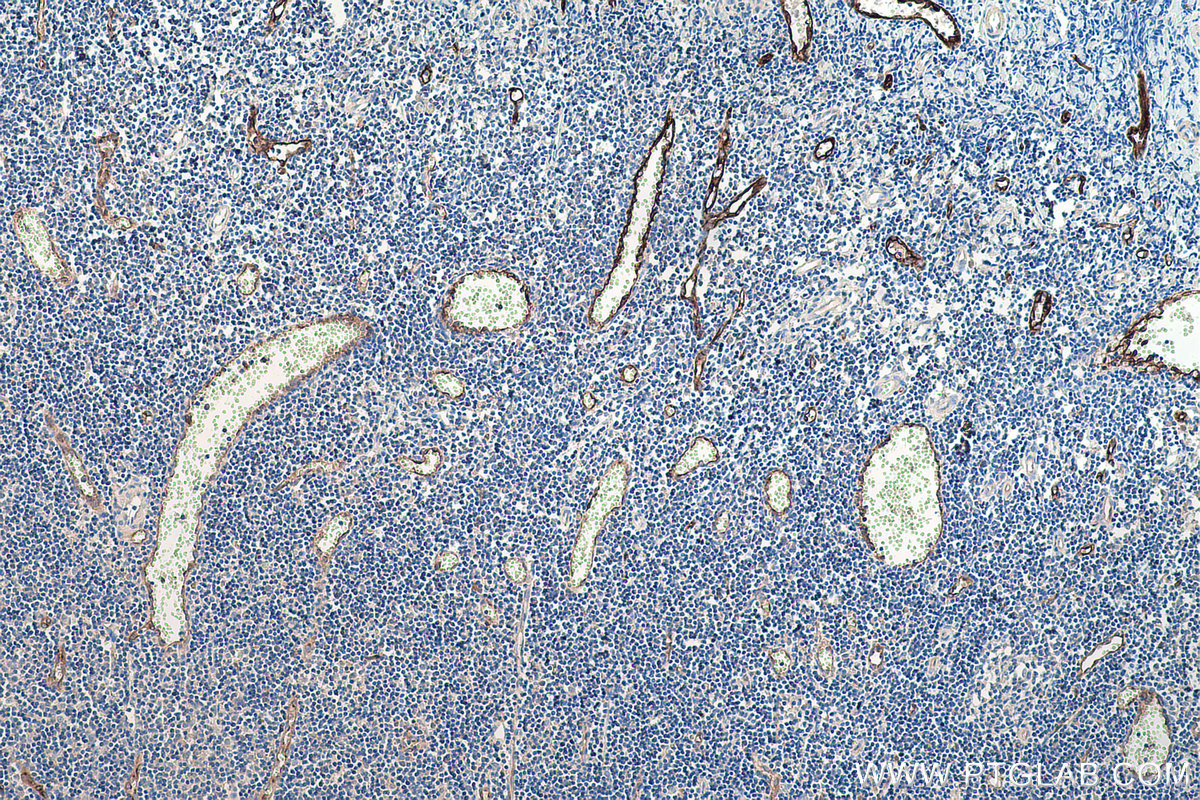 Immunohistochemical analysis of paraffin-embedded human tonsillitis tissue slide using KHC0191 (PLVAP IHC Kit).