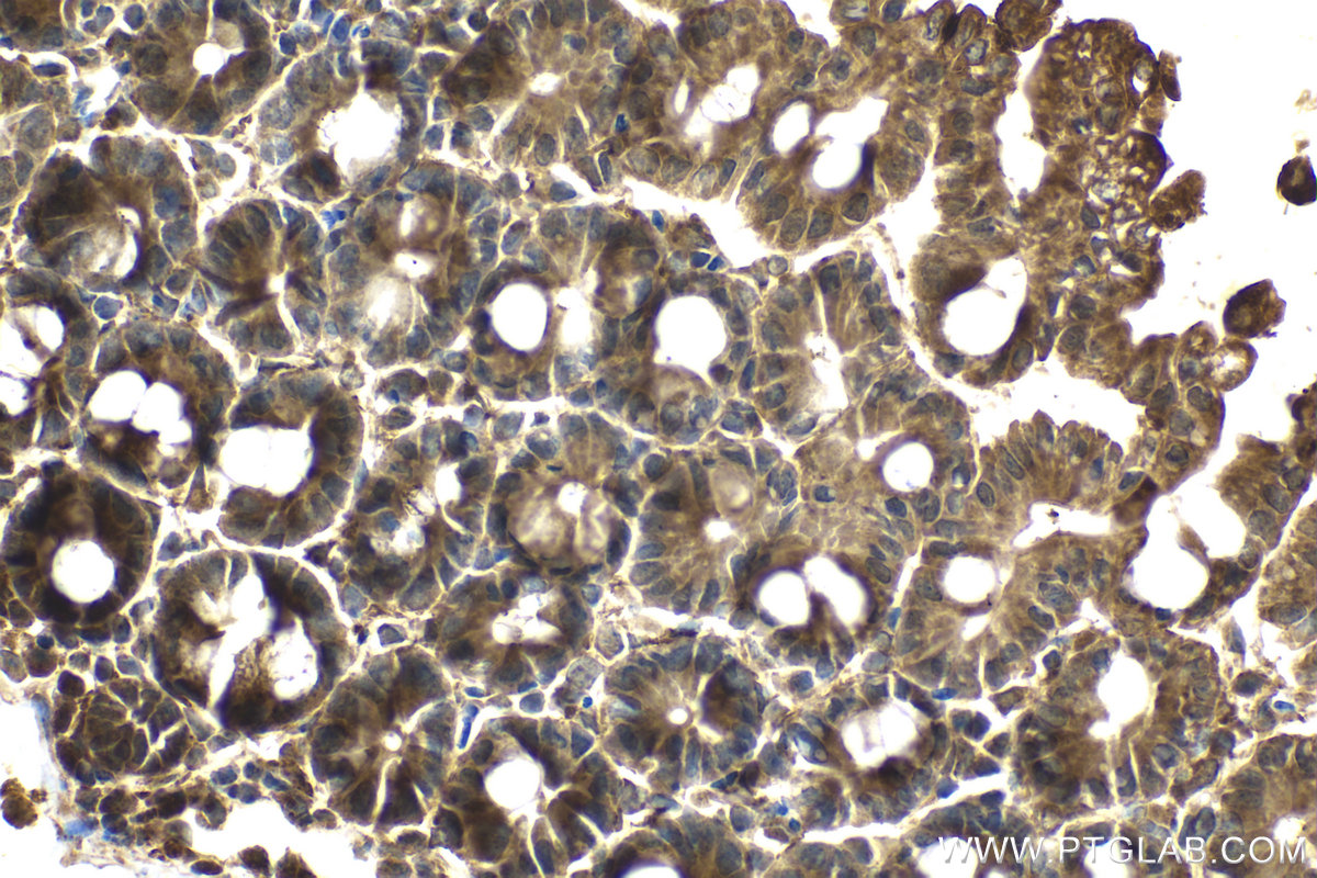 Immunohistochemical analysis of paraffin-embedded mouse intestine tissue slide using KHC2072 (PLXNB1 IHC Kit).
