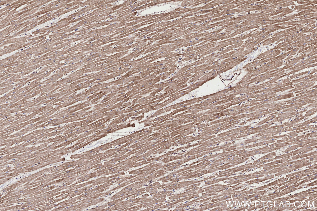 Immunohistochemical analysis of paraffin-embedded human heart tissue slide using KHC3308 (PMM1 IHC Kit).