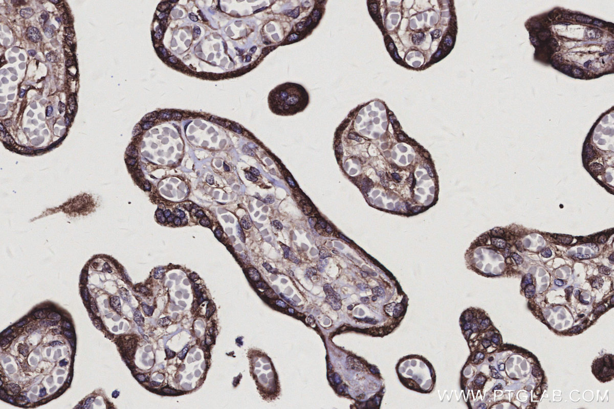 Immunohistochemical analysis of paraffin-embedded human placenta tissue slide using KHC3139 (PMM2 IHC Kit).