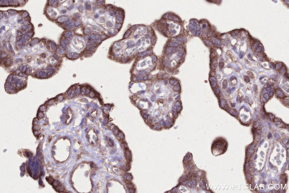 Immunohistochemical analysis of paraffin-embedded human placenta tissue slide using KHC2655 (PNPLA6 IHC Kit).