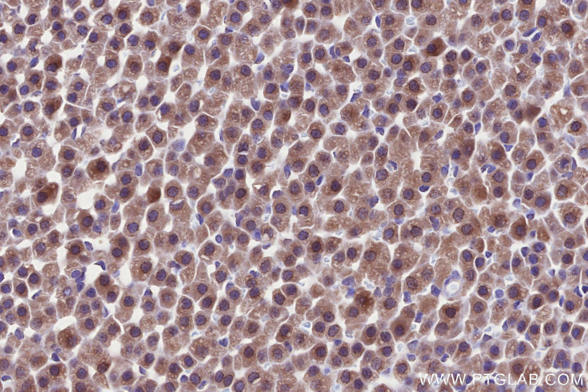 Immunohistochemical analysis of paraffin-embedded rat adrenal gland tissue slide using KHC2655 (PNPLA6 IHC Kit).