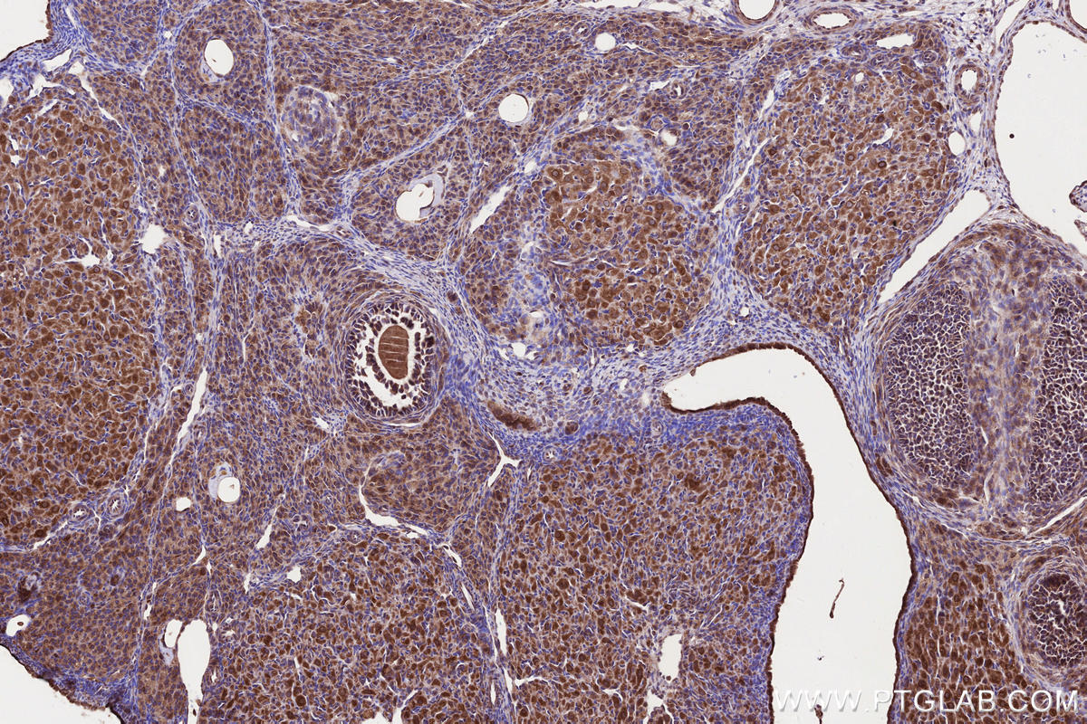 Immunohistochemical analysis of paraffin-embedded rat ovary tissue slide using KHC2655 (PNPLA6 IHC Kit).