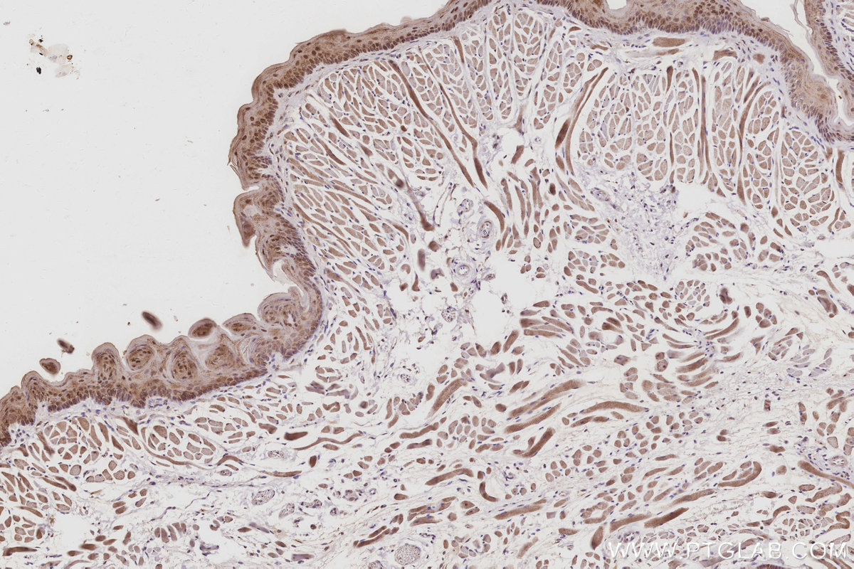 Immunohistochemical analysis of paraffin-embedded mouse tongue tissue slide using KHC3057 (POLDIP2 IHC Kit). Immunohistochemical analysis of paraffin-embedded mouse tongue tissue slide using KHC3057 (POLDIP2 IHC Kit).