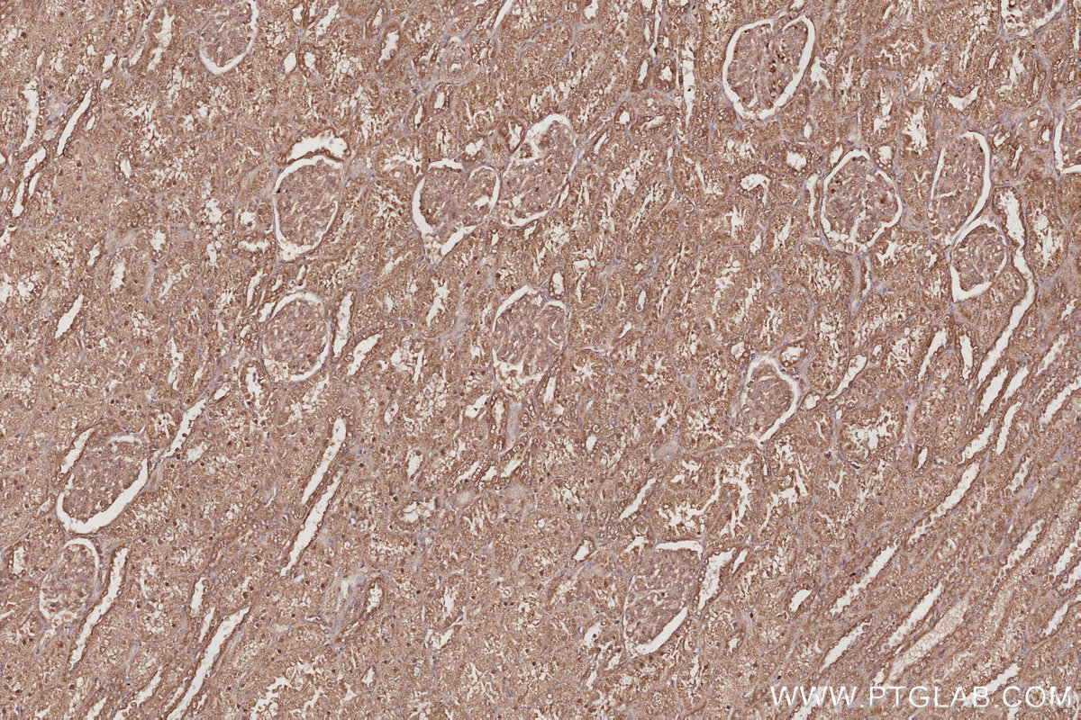Immunohistochemical analysis of paraffin-embedded human kidney tissue slide using KHC3057 (POLDIP2 IHC Kit). Immunohistochemical analysis of paraffin-embedded human kidney tissue slide using KHC3057 (POLDIP2 IHC Kit).
