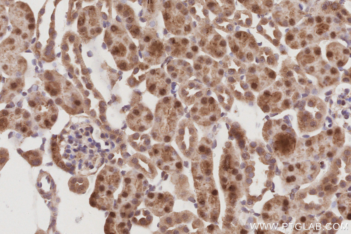 Immunohistochemical analysis of paraffin-embedded mouse kidney tissue slide using KHC3057 (POLDIP2 IHC Kit). Immunohistochemical analysis of paraffin-embedded mouse kidney tissue slide using KHC3057 (POLDIP2 IHC Kit).