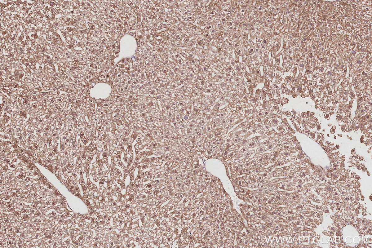 Immunohistochemical analysis of paraffin-embedded mouse liver tissue slide using KHC3057 (POLDIP2 IHC Kit). Immunohistochemical analysis of paraffin-embedded mouse liver tissue slide using KHC3057 (POLDIP2 IHC Kit).