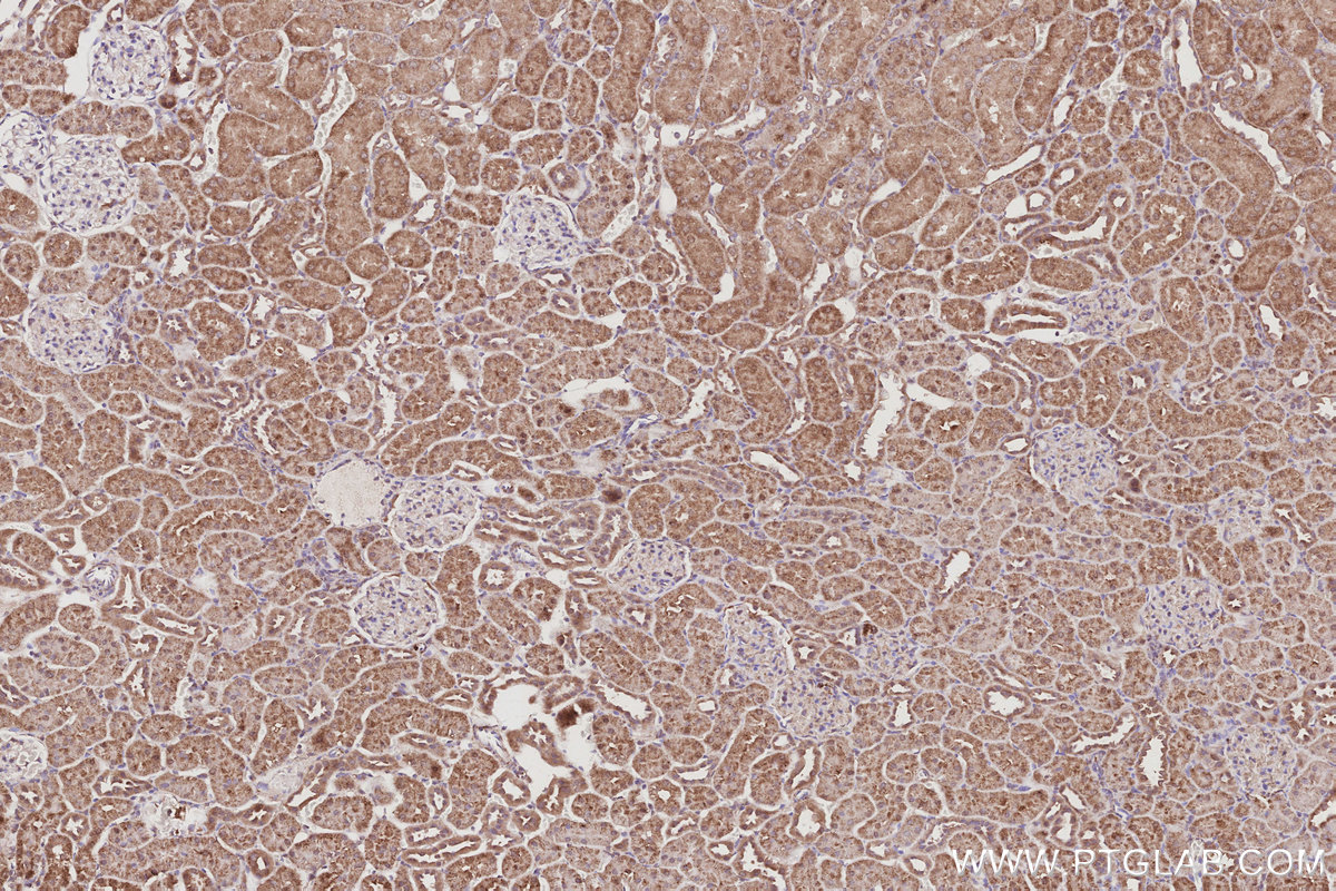 Immunohistochemical analysis of paraffin-embedded rat kidney tissue slide using KHC3057 (POLDIP2 IHC Kit). Immunohistochemical analysis of paraffin-embedded rat kidney tissue slide using KHC3057 (POLDIP2 IHC Kit).